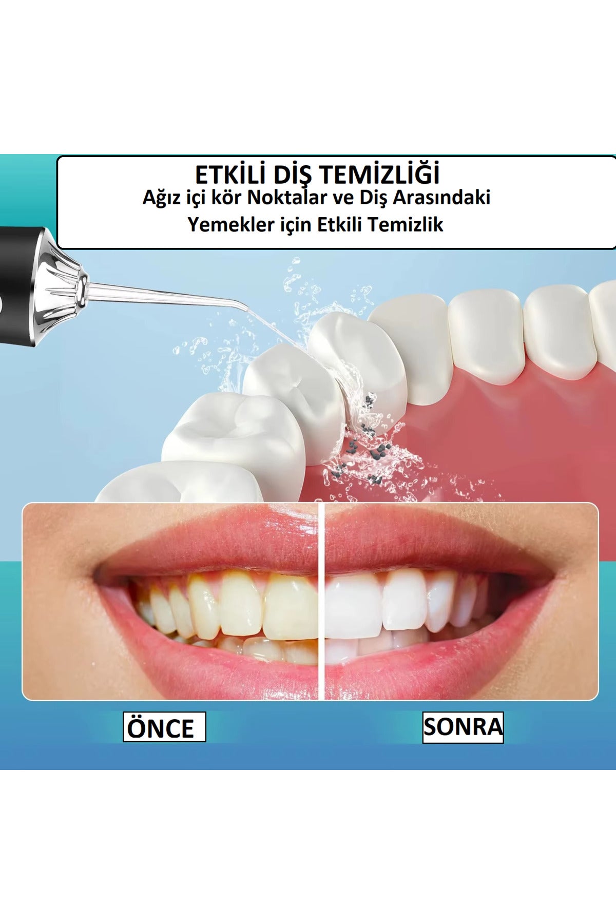 Zarifies ağız duşu set içeriği